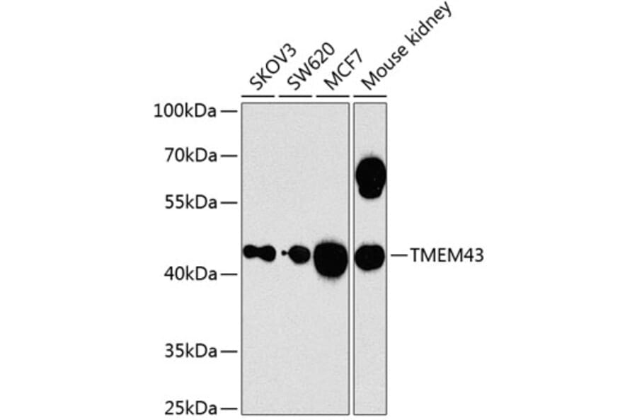 Western Blot - Anti-TMEM43 Antibody (A12271) - Antibodies.com