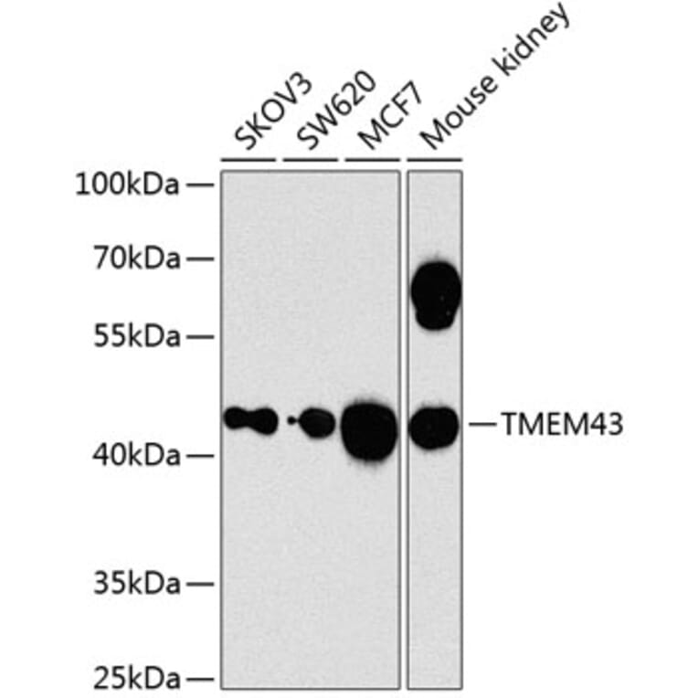 Western Blot - Anti-TMEM43 Antibody (A12271) - Antibodies.com