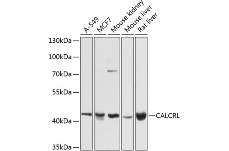 Western Blot - Anti-CRLR Antibody (A12274) - Antibodies.com