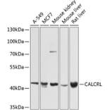 Western Blot - Anti-CRLR Antibody (A12274) - Antibodies.com
