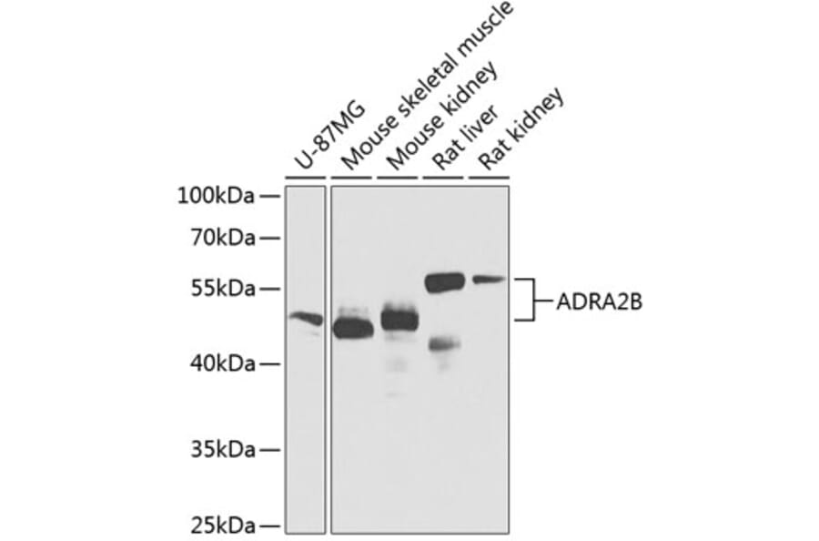 Western Blot - Anti-ADRA2B Antibody (A12275) - Antibodies.com
