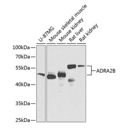 Western Blot - Anti-ADRA2B Antibody (A12275) - Antibodies.com