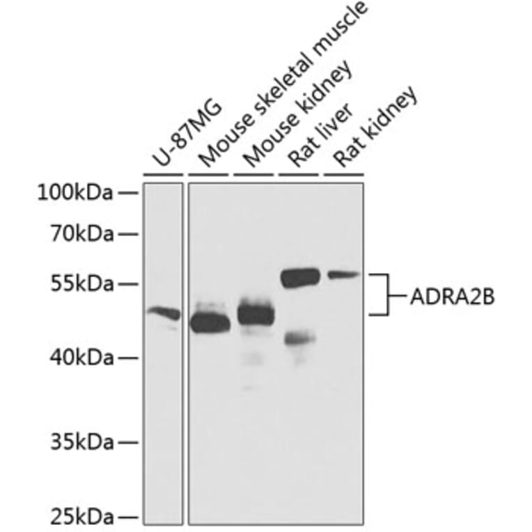 Western Blot - Anti-ADRA2B Antibody (A12275) - Antibodies.com