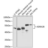 Western Blot - Anti-ADRA2B Antibody (A12275) - Antibodies.com