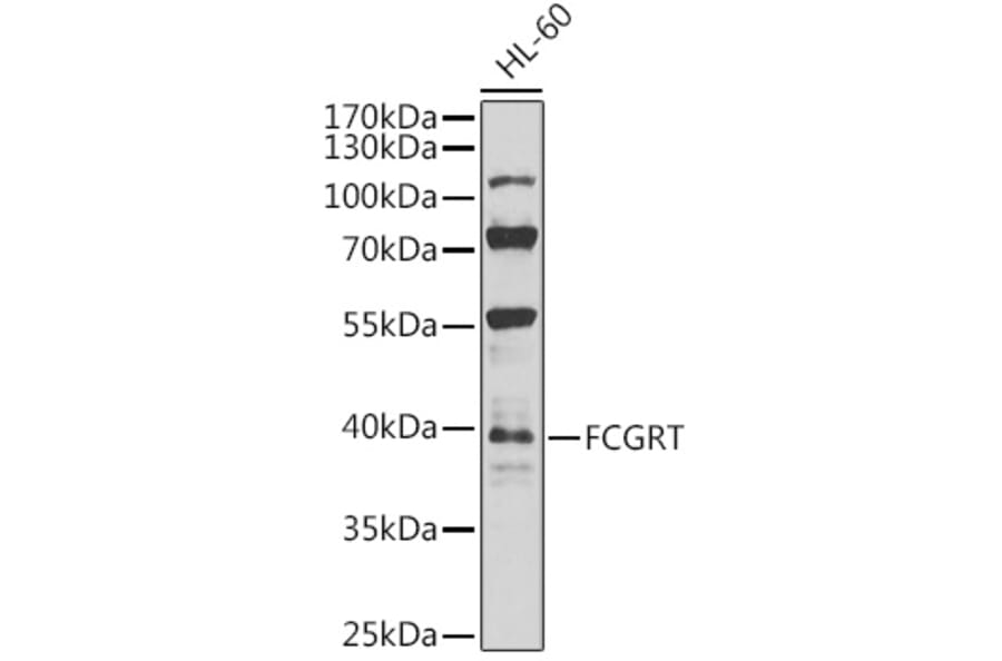 Western Blot - Anti-FCGRT/FCRN Antibody (A12277) - Antibodies.com