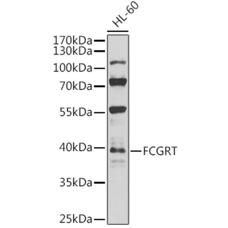 Western Blot - Anti-FCGRT/FCRN Antibody (A12277) - Antibodies.com