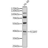Western Blot - Anti-FCGRT/FCRN Antibody (A12277) - Antibodies.com
