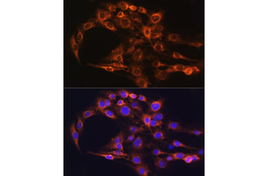 Immunofluorescence - Anti-FCGRT/FCRN Antibody (A12277) - Antibodies.com