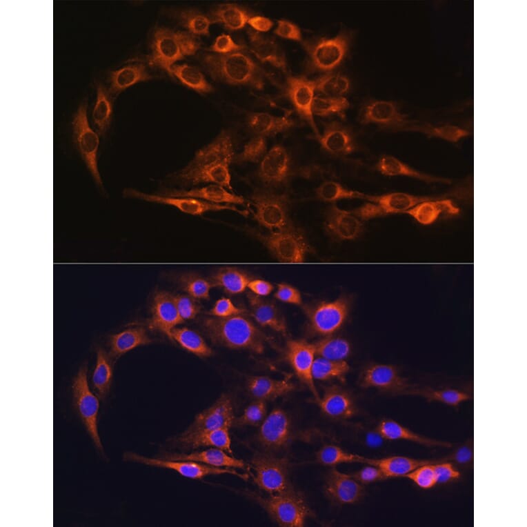 Immunofluorescence - Anti-FCGRT/FCRN Antibody (A12277) - Antibodies.com