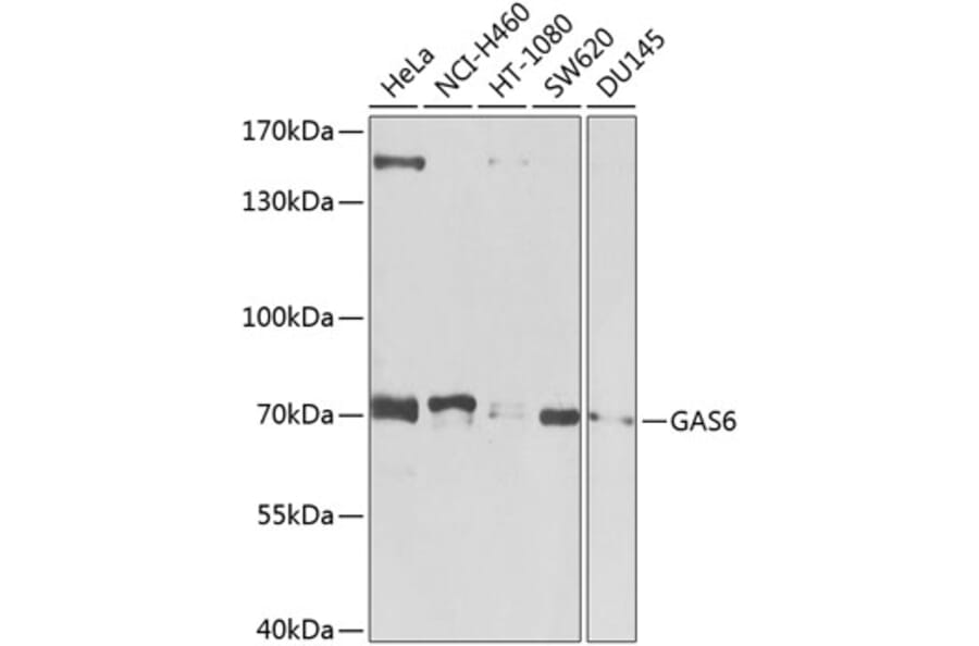 Western Blot - Anti-GAS 6 Antibody (A12278) - Antibodies.com