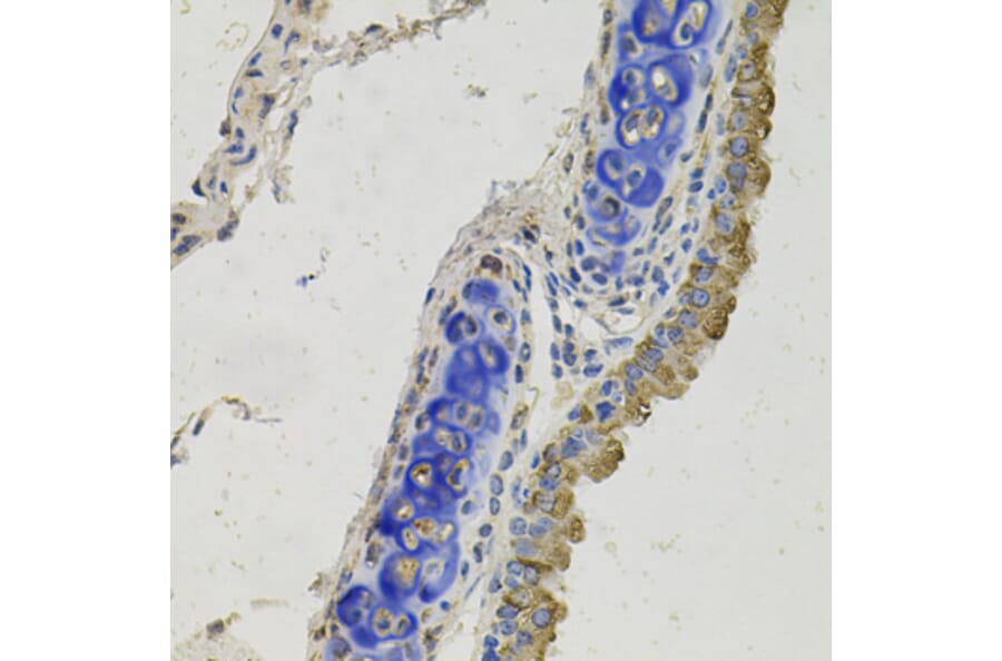 Immunohistochemistry - Anti-GAS 6 Antibody (A12278) - Antibodies.com