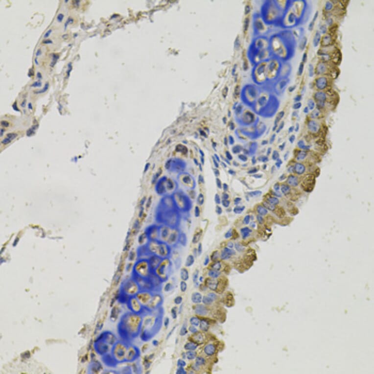 Immunohistochemistry - Anti-GAS 6 Antibody (A12278) - Antibodies.com