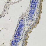 Immunohistochemistry - Anti-GAS 6 Antibody (A12278) - Antibodies.com