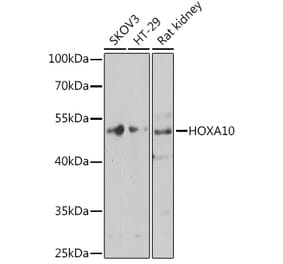 Western Blot - Anti-HOXA10 Antibody (A12279) - Antibodies.com