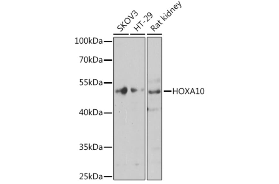 Western Blot - Anti-HOXA10 Antibody (A12279) - Antibodies.com