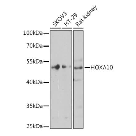 Western Blot - Anti-HOXA10 Antibody (A12279) - Antibodies.com