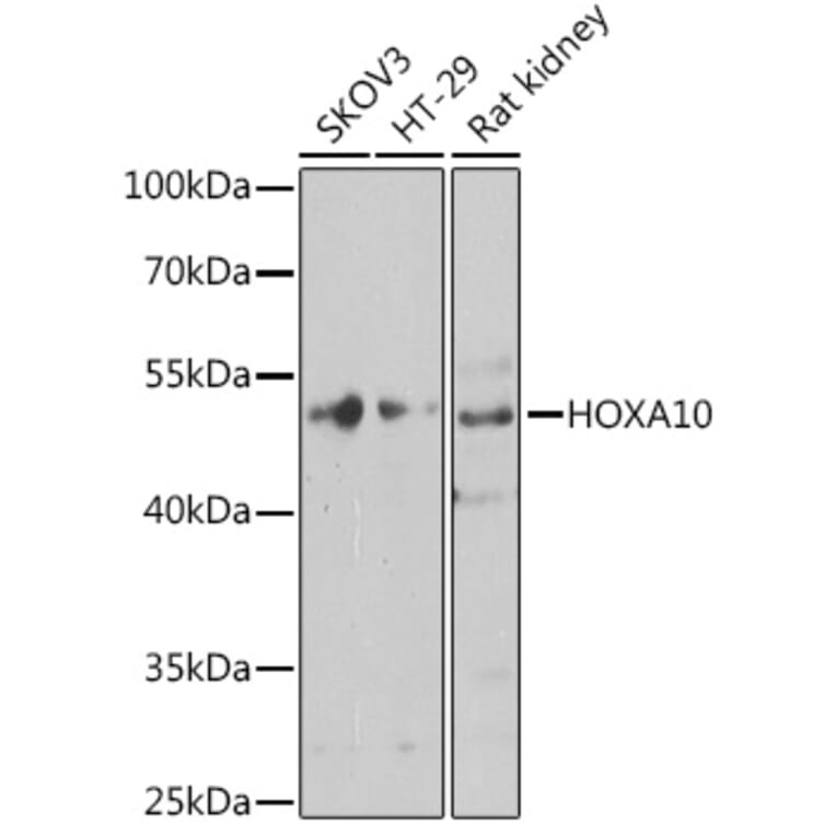 Western Blot - Anti-HOXA10 Antibody (A12279) - Antibodies.com