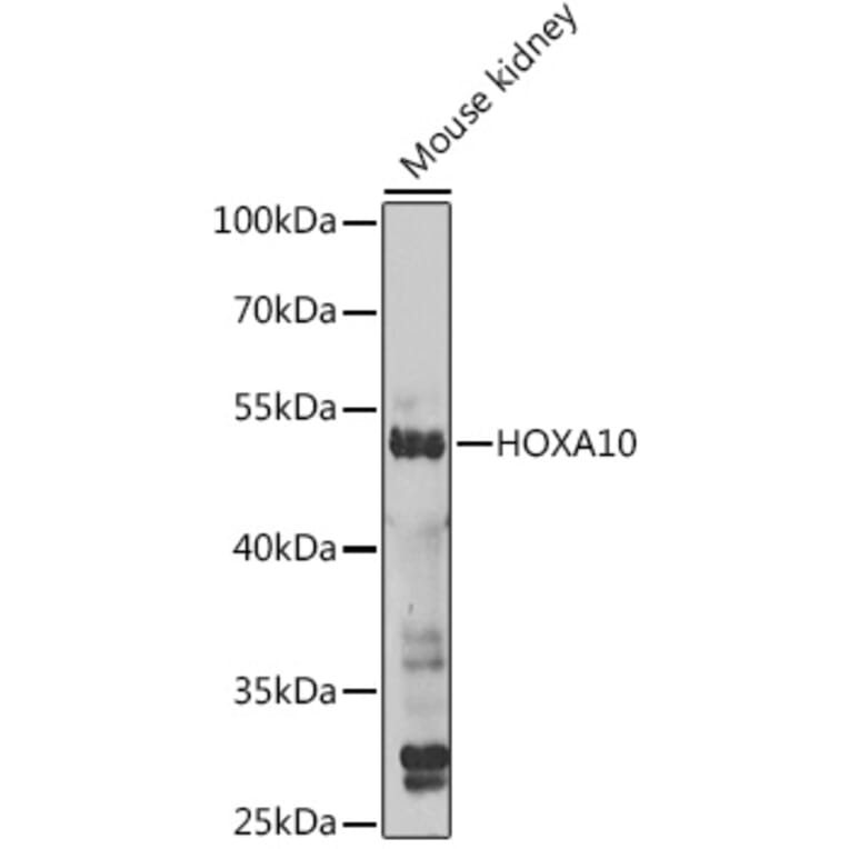 Western Blot - Anti-HOXA10 Antibody (A12279) - Antibodies.com