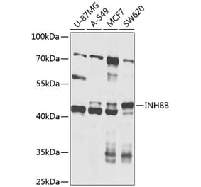 Western Blot - Anti-Inhibin beta B Antibody (A12280) - Antibodies.com