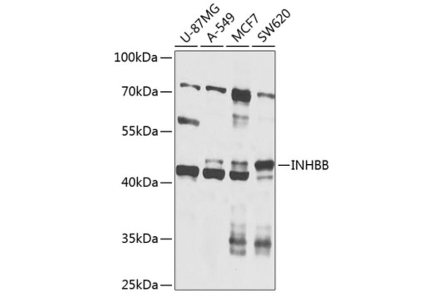Western Blot - Anti-Inhibin beta B Antibody (A12280) - Antibodies.com