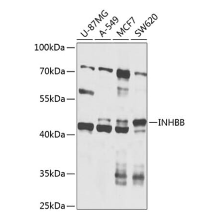 Western Blot - Anti-Inhibin beta B Antibody (A12280) - Antibodies.com