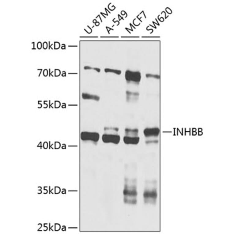 Western Blot - Anti-Inhibin beta B Antibody (A12280) - Antibodies.com