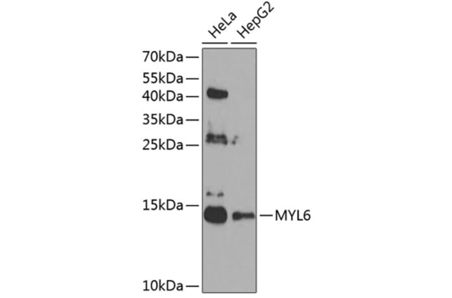 Western Blot - Anti-Myosin Antibody (A12281) - Antibodies.com