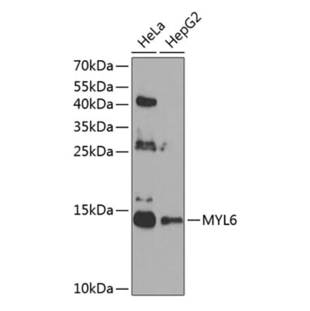 Western Blot - Anti-Myosin Antibody (A12281) - Antibodies.com