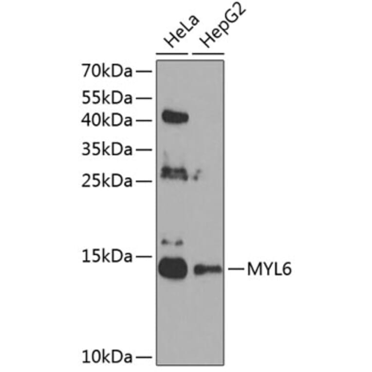 Western Blot - Anti-Myosin Antibody (A12281) - Antibodies.com