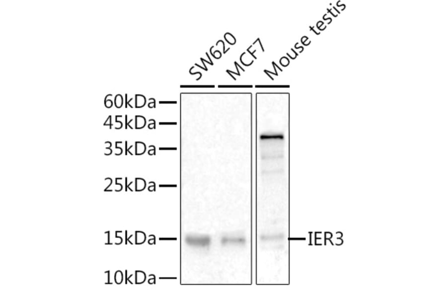 Western Blot - Anti-IEX1/IER3 Antibody (A12282) - Antibodies.com