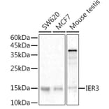 Western Blot - Anti-IEX1/IER3 Antibody (A12282) - Antibodies.com