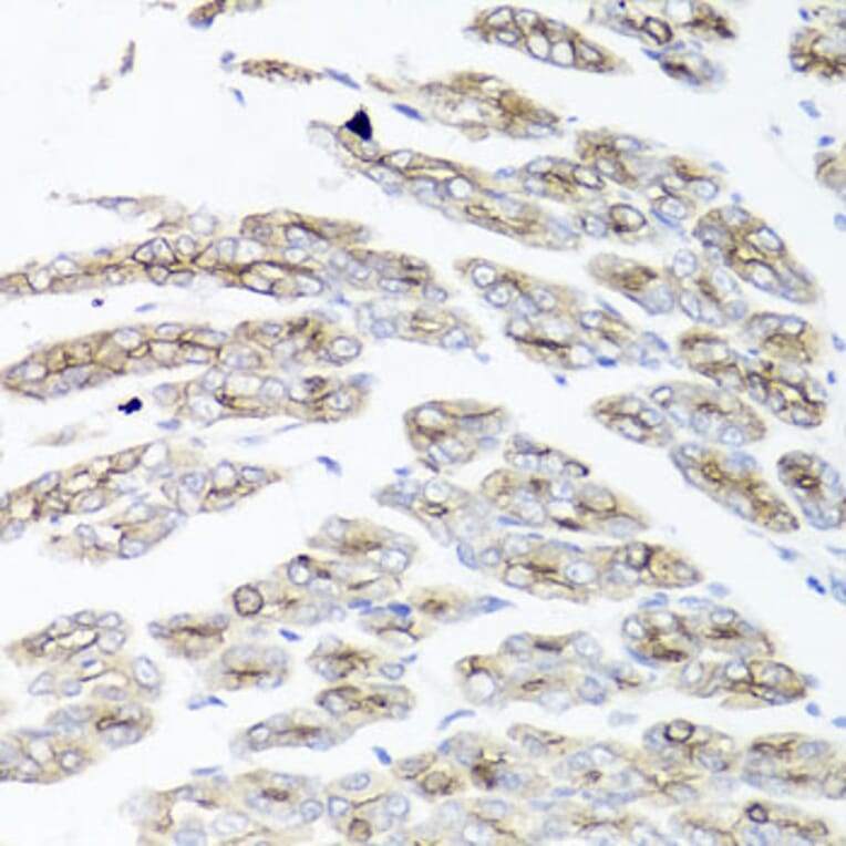 Immunohistochemistry - Anti-IEX1/IER3 Antibody (A12282) - Antibodies.com