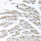 Immunohistochemistry - Anti-IEX1/IER3 Antibody (A12282) - Antibodies.com