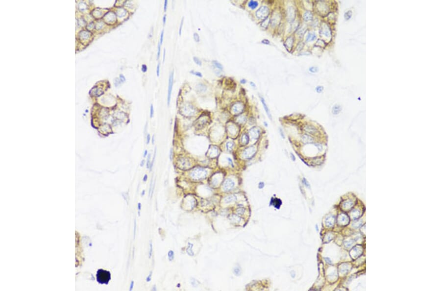 Immunohistochemistry - Anti-IEX1/IER3 Antibody (A12282) - Antibodies.com