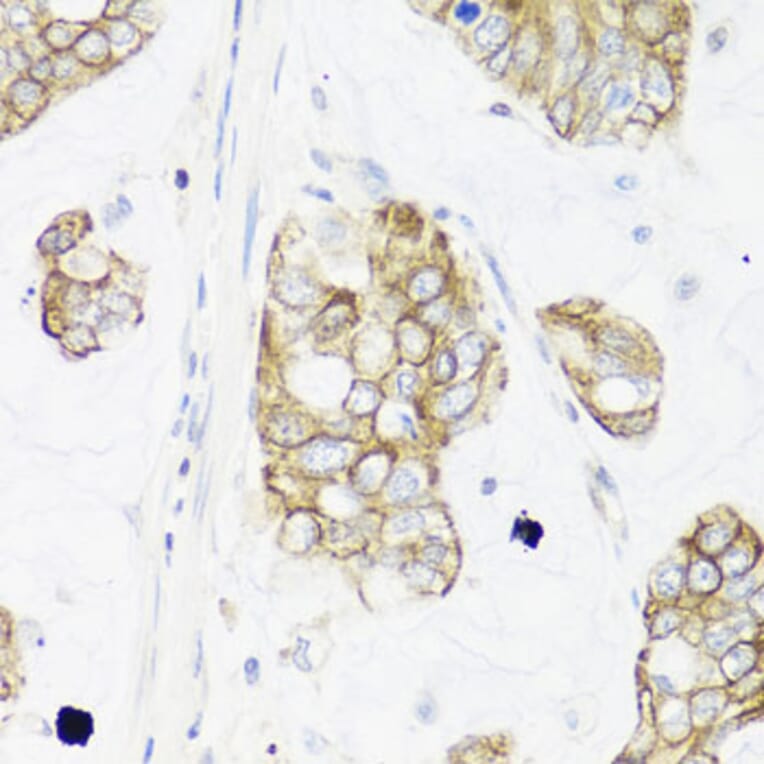 Immunohistochemistry - Anti-IEX1/IER3 Antibody (A12282) - Antibodies.com