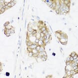 Immunohistochemistry - Anti-IEX1/IER3 Antibody (A12282) - Antibodies.com