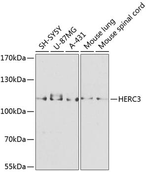 Western blot analysis of extracts of various cell lines, using Anti-HERC3 Antibody (A8567) at 1:1,000 dilution.
Secondary antibody: Goat Anti-Rabbit IgG (H+L) (HRP) (AS014) at 1:10,000 dilution.
Lysates / proteins: 25µg per lane.
Blocking buffer: 3% non-fat dry milk in TBST.
Detection: ECL Basic Kit (RM00020).
Exposure time: 30s.