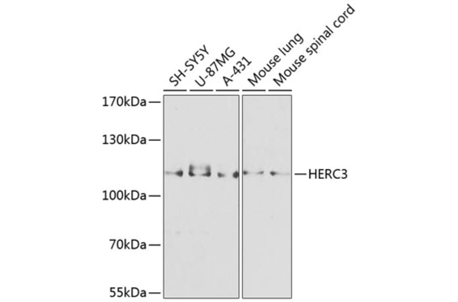 Western Blot - Anti-HERC3 Antibody (A12283) - Antibodies.com