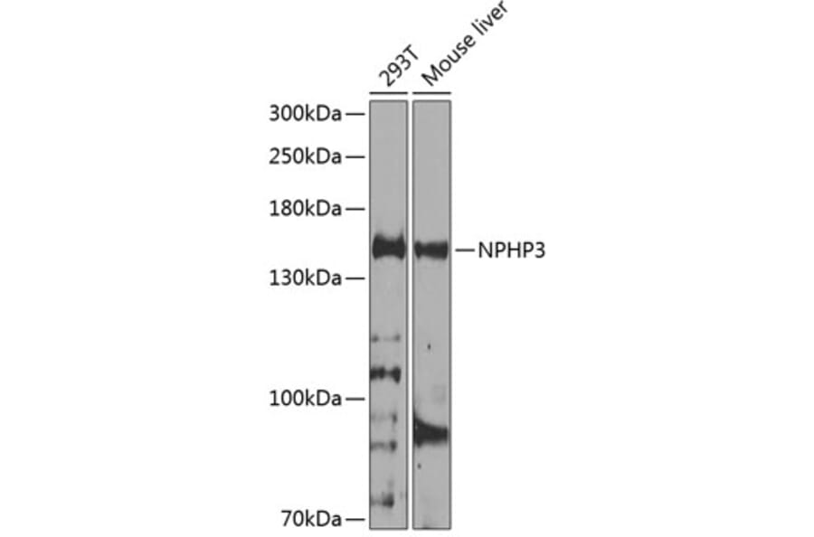 Western Blot - Anti-NPHP3 Antibody (A12284) - Antibodies.com