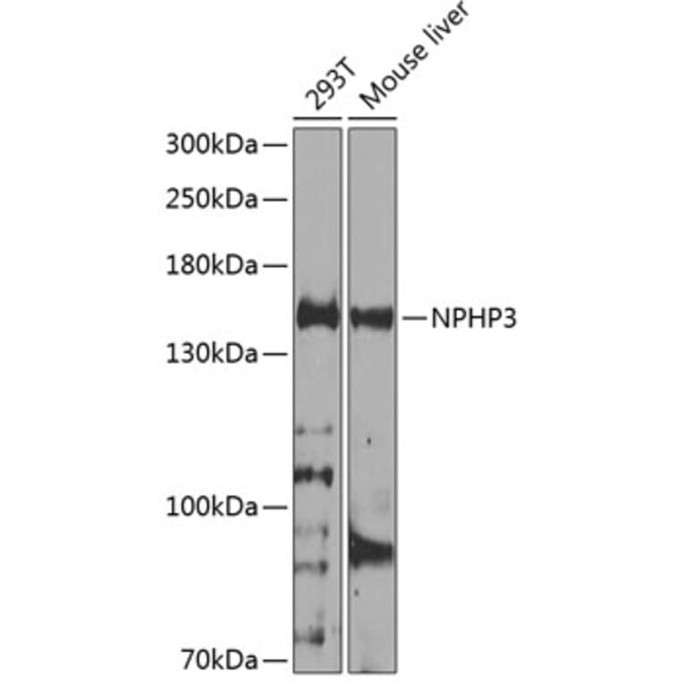 Western Blot - Anti-NPHP3 Antibody (A12284) - Antibodies.com