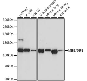 Western Blot - Anti-Mib1/Mindbomb Antibody (A12285) - Antibodies.com
