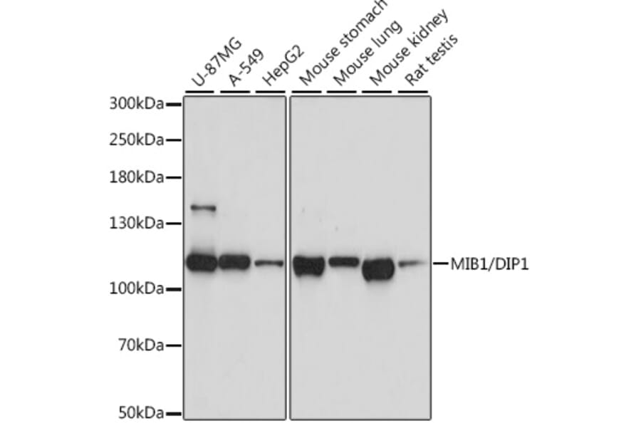 Western Blot - Anti-Mib1/Mindbomb Antibody (A12285) - Antibodies.com