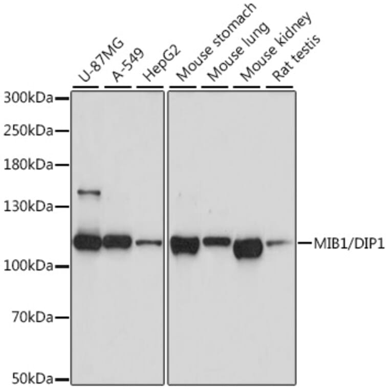 Western Blot - Anti-Mib1/Mindbomb Antibody (A12285) - Antibodies.com