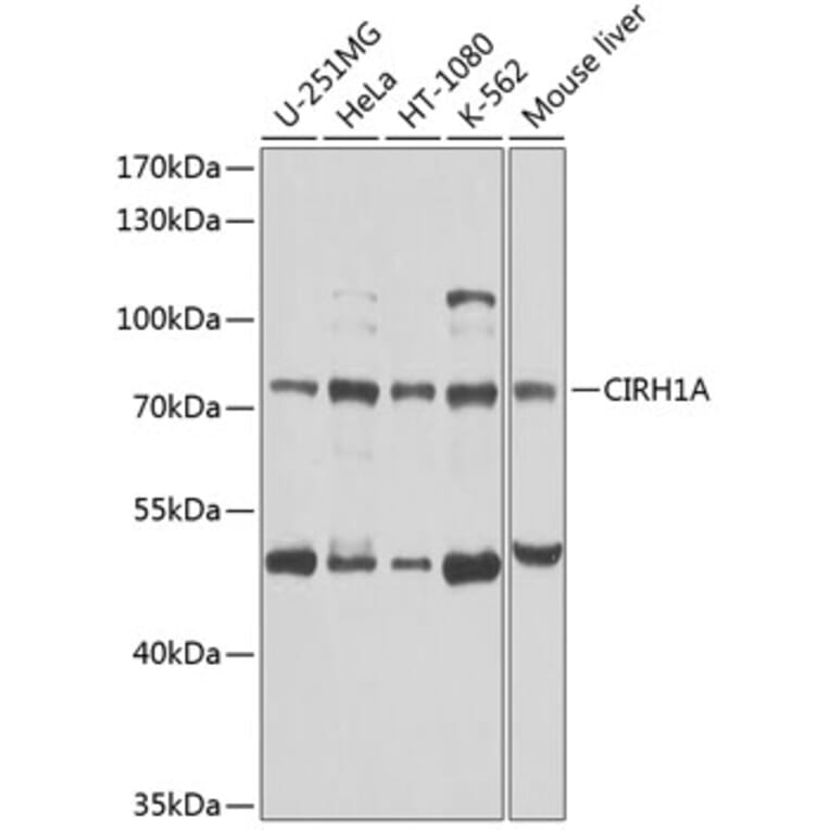 Western Blot - Anti-Cirhin Antibody (A12286) - Antibodies.com