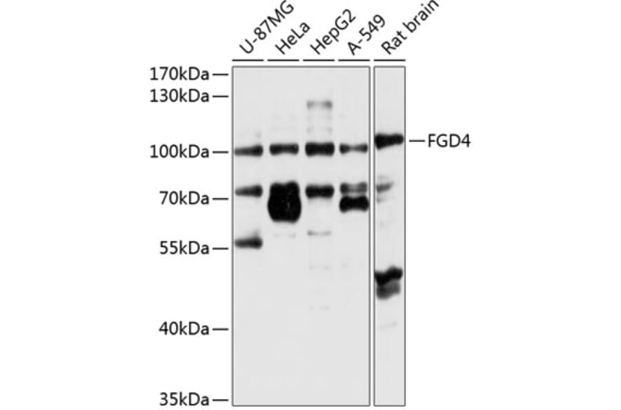 Western Blot - Anti-FGD4 Antibody (A12287) - Antibodies.com