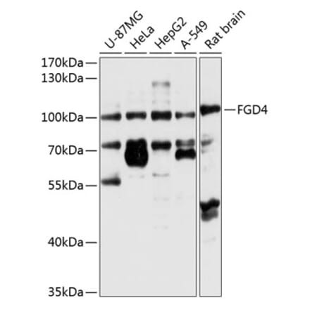 Western Blot - Anti-FGD4 Antibody (A12287) - Antibodies.com
