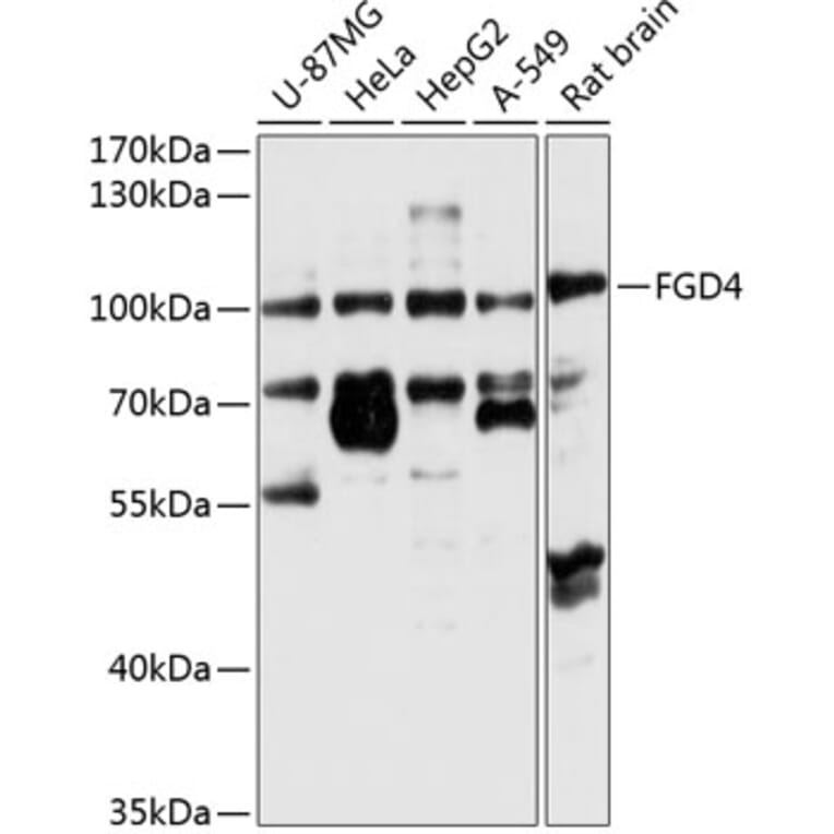 Western Blot - Anti-FGD4 Antibody (A12287) - Antibodies.com