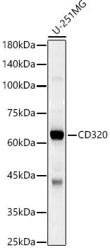 Western blot analysis of extracts of mouse testis, using Anti-CD320 Antibody (A8627) at 1:1,000 dilution.
Secondary antibody: Goat Anti-Rabbit IgG (H+L) (HRP) (AS014) at 1:10,000 dilution.
Lysates / proteins: 25µg per lane.
Blocking buffer: 3% non-fat dry milk in TBST.
Detection: ECL Basic Kit (RM00020).
Exposure time: 30s.
