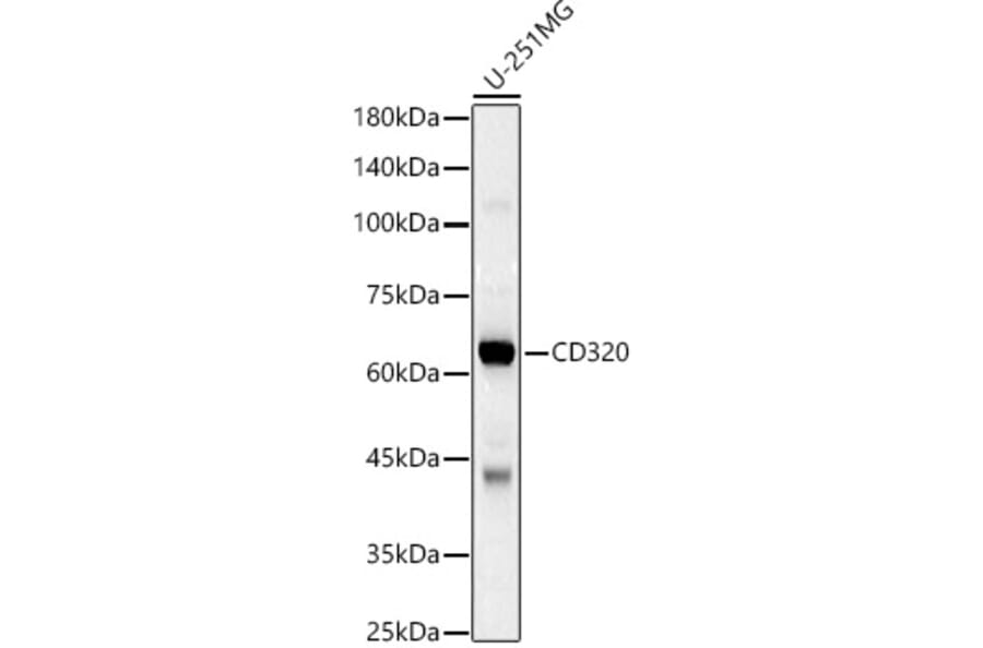 Western Blot - Anti-TCblR Antibody (A12289) - Antibodies.com
