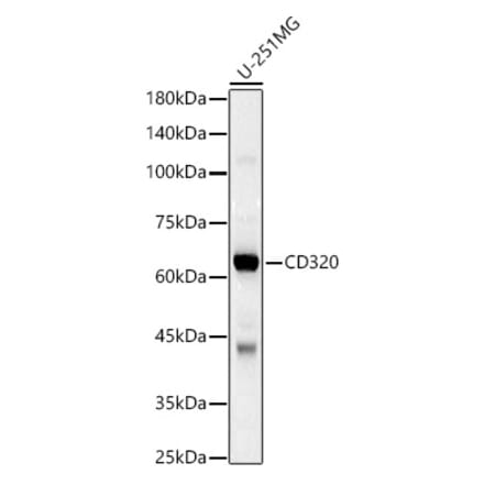 Western Blot - Anti-TCblR Antibody (A12289) - Antibodies.com